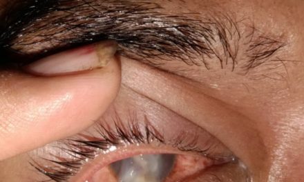 Lagi Program “Al Haris” Di Duga Gagal Dan Tidak Transparan