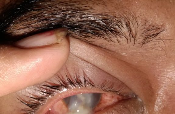 Lagi Program “Al Haris” Di Duga Gagal Dan Tidak Transparan