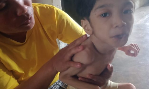 Elia/ibu sela hati hulu mengharapkan bantuan Dermawan