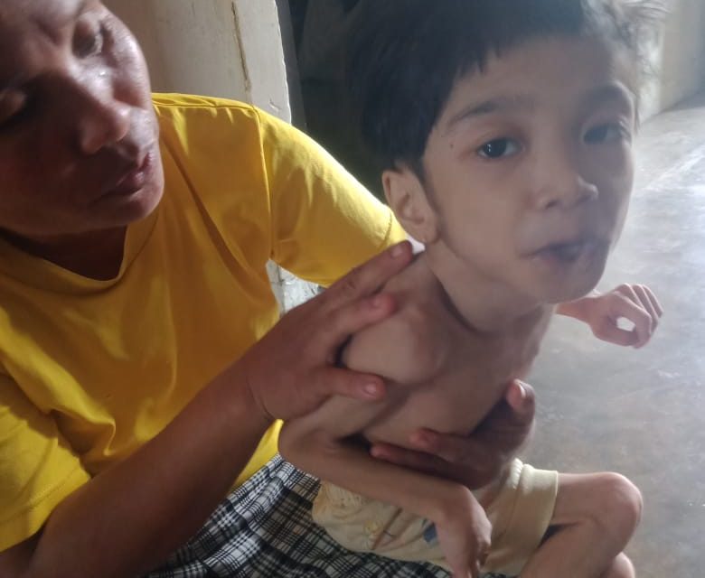 Elia/ibu sela hati hulu mengharapkan bantuan Dermawan