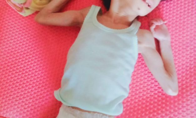 Elia, Bocah Difabel yang Gagal Terdata: Negara Hadir Saat Kampanye, Absen Saat Dibutuhkan