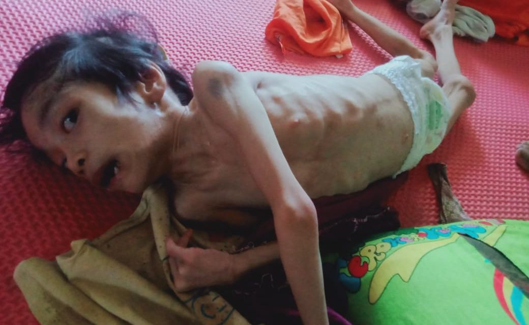 Elia Belum Sembuh, Dukungan Pemerintah Masih Dinanti