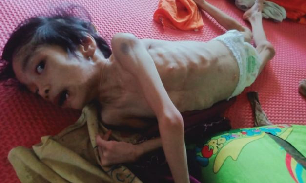 Elia Belum Sembuh, Dukungan Pemerintah Masih Dinanti