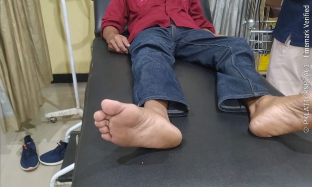 Adv Donny Andretti Tegas: 1.800 Advokat Dan Paralegal Siap Kawal Kasus Penganiayaan Di Kantor Redaksi Cybertni.Id